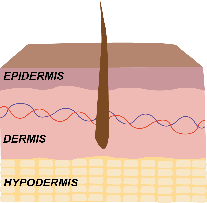 Hudens olika lager med epidermis överst, dermis i mellan och hypodermis underst. 